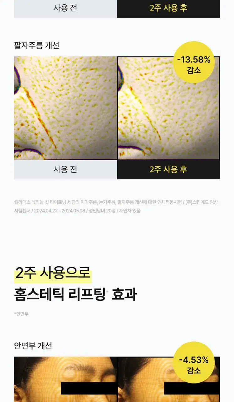[모공/탄력/결] 셀리맥스 더 비타 A 레티놀 샷 타이트닝 세럼 30ml 상세페이지 26